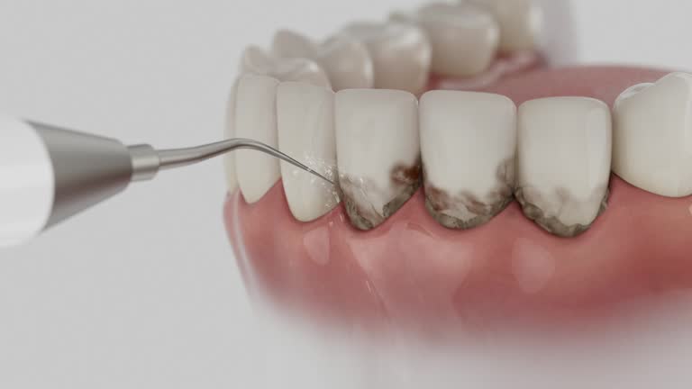 Reliable Invisalign Clear Aligners contractor in Calhoun County County, MS by Dentist Open Now